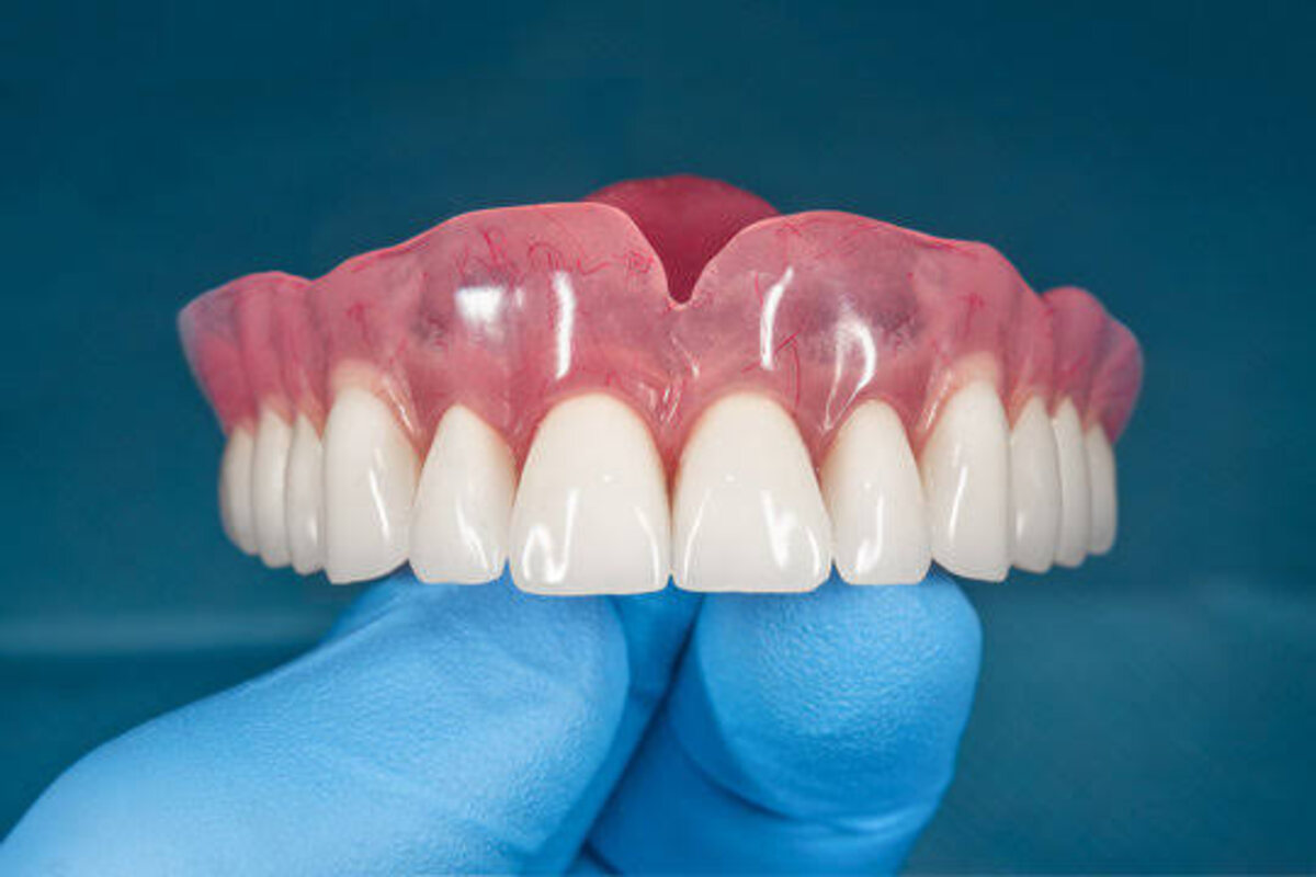 Artificial teeth dental prosthetic